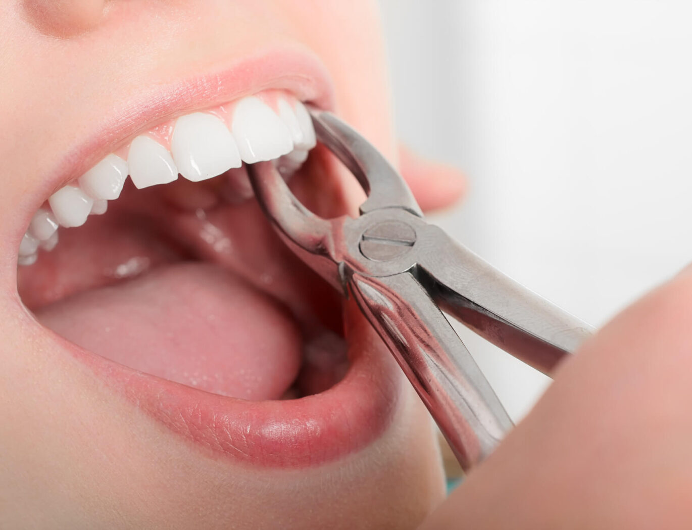 is-a-tooth-extraction-painful